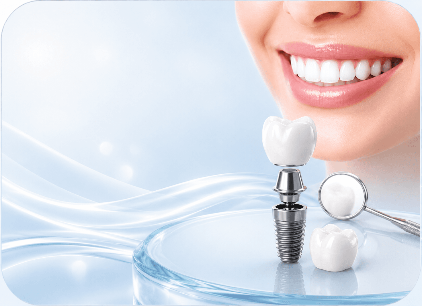 Single-Tooth Dental Implant